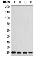 1 - Anti-CABP5 Antibody AP51739