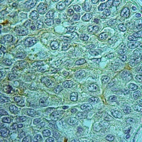 19 - Anti-MRP2 Antibody AP51740
