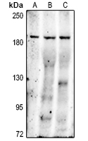 1 - Anti-MRP2 Antibody AP51740