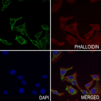 3 - Anti-Carbonic Anhydrase 6 Antibody AP51741