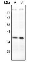 1 - Anti-Carbonic Anhydrase 6 Antibody AP51741
