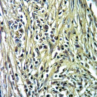 19 - Anti-Carboxypeptidase N 2 Antibody AP51742