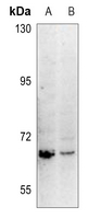 1 - Anti-Carboxypeptidase N 2 Antibody AP51742