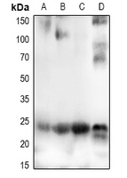 1 - Anti-CHAC1 Antibody AP51743