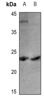 1 - Anti-Cerebellin 1 Antibody AP51745