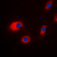 3 - Anti-CLCN7 Antibody AP51746