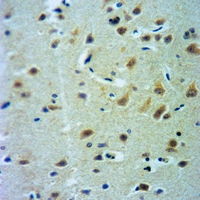 19 - Anti-CLCN7 Antibody AP51746