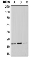 1 - Anti-Claudin 9 Antibody AP51749
