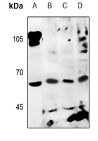 1 - Anti-Factor I Antibody AP51750