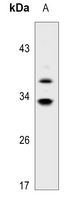 1 - Anti-HSD11B1 Antibody AP51753