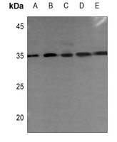 1 - Anti-DHRS2 Antibody AP51756
