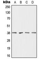 1 - Anti-DHRS7 Antibody AP51757