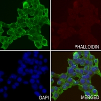 3 - Anti-Desmoglein 3 Antibody AP51758