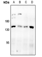 1 - Anti-Desmoglein 3 Antibody AP51758