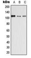 1 - Anti-Desmoglein 4 Antibody AP51759