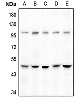 1 - Anti-DGAT2 Antibody AP51760