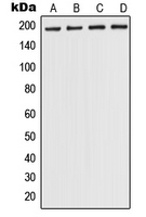 1 - Anti-POLR1A Antibody AP51762