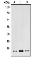 1 - Anti-POLR2I Antibody AP51763