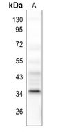 1 - Anti-POLR3F Antibody AP51764