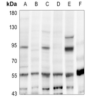 1 - Anti-CD248 Antibody AP51768