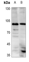 1 - Anti-ETAA1 Antibody AP51769