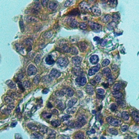 19 - Anti-HPGDS Antibody AP51775