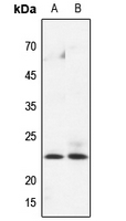 1 - Anti-HPGDS Antibody AP51775