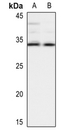 1 - Anti-HLA-DOB Antibody AP51778
