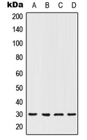 1 - Anti-HOXC12 Antibody AP51779