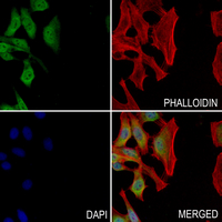 3 - Anti-MAD2L1BP Antibody AP51787