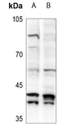 1 - Anti-MAD2L1BP Antibody AP51787
