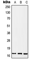 1 - Anti-MGST2 Antibody AP51791