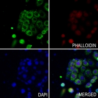 3 - Anti-SLC25A11 Antibody AP51792