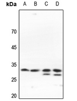 1 - Anti-SLC25A11 Antibody AP51792