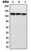 1 - Anti-MPP9 Antibody AP51793