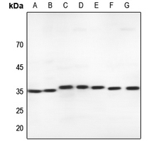 1 - Anti-MLF1 Antibody AP51795
