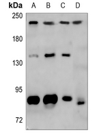 1 - Anti-Myosin 8 Antibody AP51796