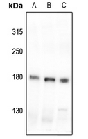 1 - Anti-MYO3B Antibody AP51797