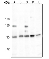 1 - Anti-ESCO1 Antibody AP51799
