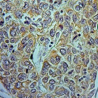 19 - Anti-NDUFA9 Antibody AP51800