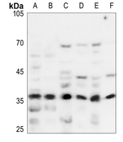 1 - Anti-NDUFA9 Antibody AP51800