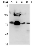 1 - Anti-NDUFS1 Antibody AP51801