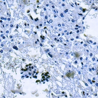 19 - Anti-MT-ND2 Antibody AP51802