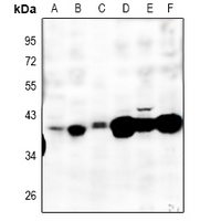 1 - Anti-MT-ND2 Antibody AP51802