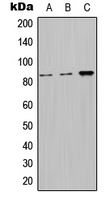 1 - Anti-Nephrocystin 1 Antibody AP51803