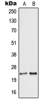 1 - Anti-Secretogranin 5 Antibody AP51808