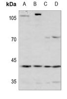 1 - Anti-ARD1 Antibody AP51809
