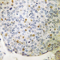 19 - Anti-CIP29 Antibody AP51810