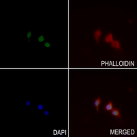 3 - Anti-OAT Antibody AP51811