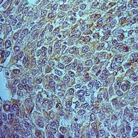 19 - Anti-OAT Antibody AP51811